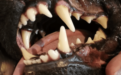 Zahnrestauration nach Schmelzdefekt